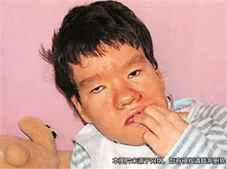 女儿患智力残疾，起诉离异父亲增加抚养费