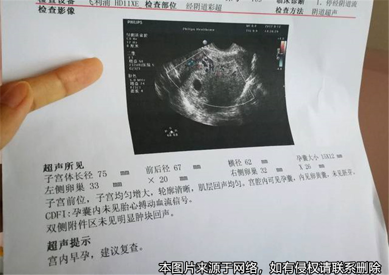 丈夫以妻子两次擅自流产为由起诉离婚并索要赔偿